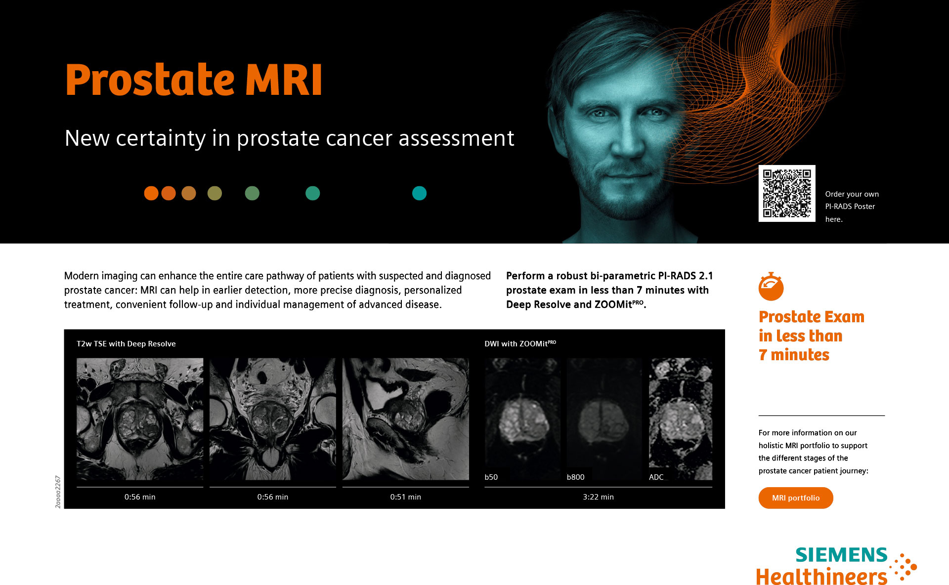 Prostate MRI - New certainty in prostate cancer assessment